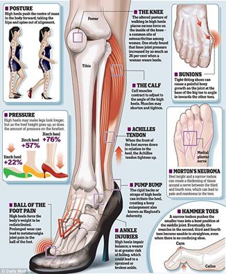 Thongs or high hill shoes are damaging to the feet structure -  ReleaseRemedial